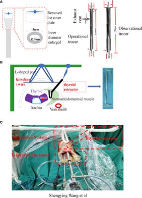 Novel Trocars and Suspension System Application in Gasless Transoral Endoscopic Thyroidectomy Vestibular Approach Oral Endoscopic Surgery